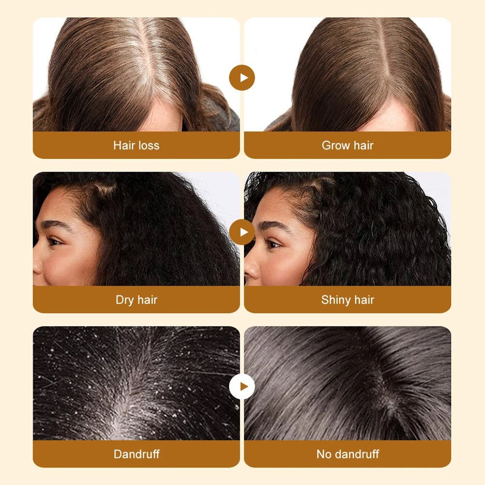 SAUVASINE Pure Batana Hair Oil For Thicker Fuller Hair Growth & Repair