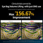 Dr Melaxin Eyephalt Eye Cream For Under Eye Bags Dark Circles & Puffiness