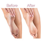 Rechargeable Electric Pedicure Foot File Callus Remover With 2 Speeds