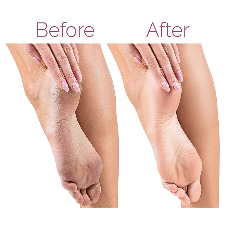 Rechargeable Electric Pedicure Foot File Callus Remover With 2 Speeds