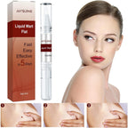 JAYSUING Liquid Wart Flat Remover Fast 5 Day Skin Clearing Formula