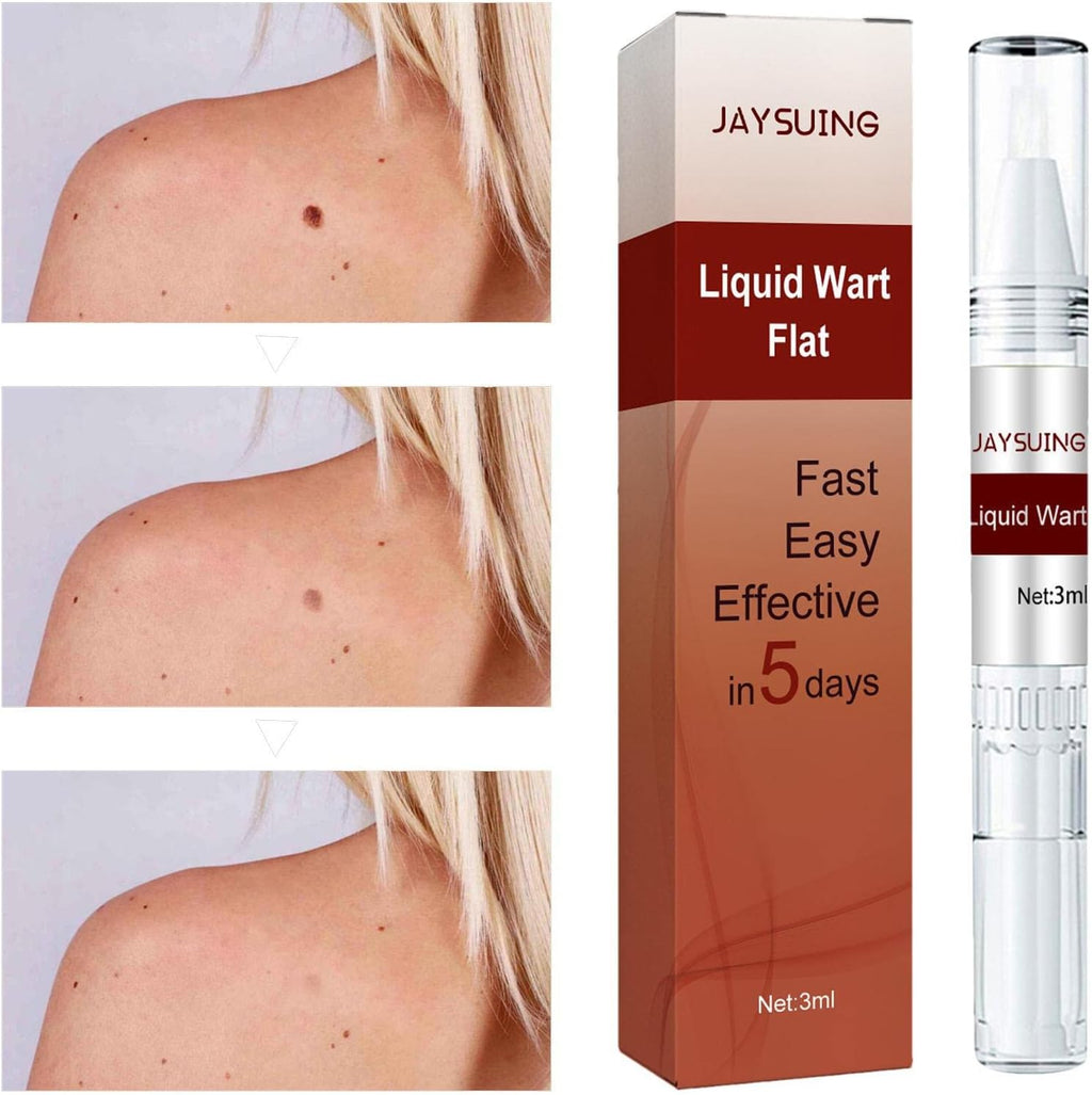 JAYSUING Liquid Wart Flat Remover Fast 5 Day Skin Clearing Formula