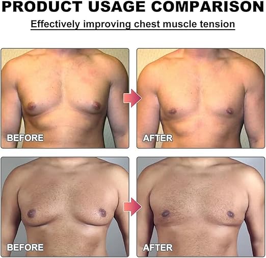 Men Therm Bee Venom Gynecomastia Heating Oil For Chest Firming & Fat Burn
