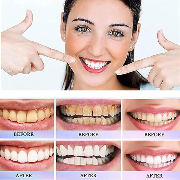 Oralhoe - Nicotinamide Dazzle White Toothpaste
