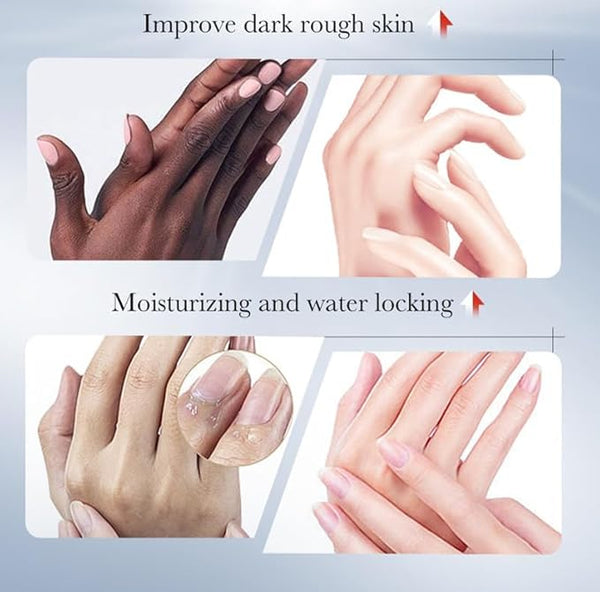 Sadoer Kojic Acid Hand Cream For Soft Bright Smooth Hydrated Hands