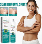 South Moon Medical Grade Scar Spray For Burns Surgery & Stretch Marks