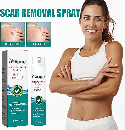 South Moon Medical Grade Scar Spray For Burns Surgery & Stretch Marks