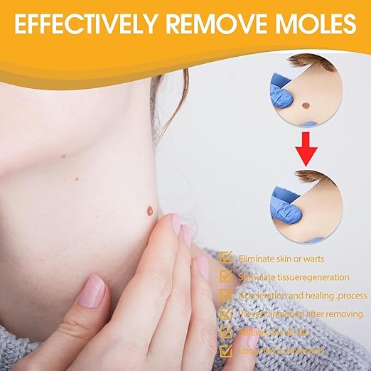 Tag Recede Bee Venom Wart & Skin Tag Removal Repair Spray Maximum Care