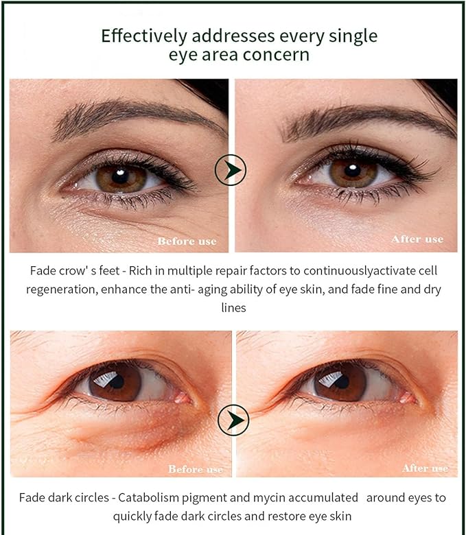 Time Eraser Eye Essence Oil For Fine Lines Puffiness And Hydration Care