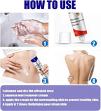 Fast Acting Warts Remover Liquid For Hands Feet & Face Maximum Strength